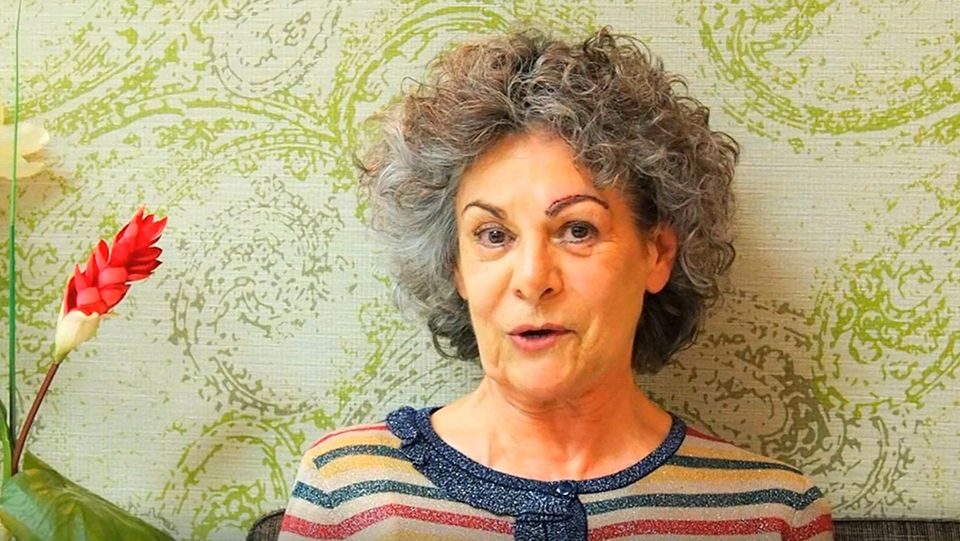 Testimonios-Minilifting-Ceja-Paciente